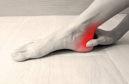 Achilles Tendon issues