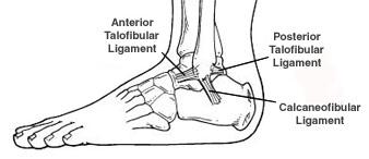 Weiss Foot & Ankle can help with Ankle Sprain