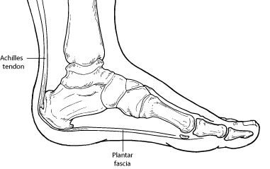 Plantar Fasciitis (Heel Pain)